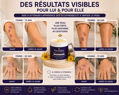 Fermélia™️ — Redonne fermeté et confort à ta peau fragile